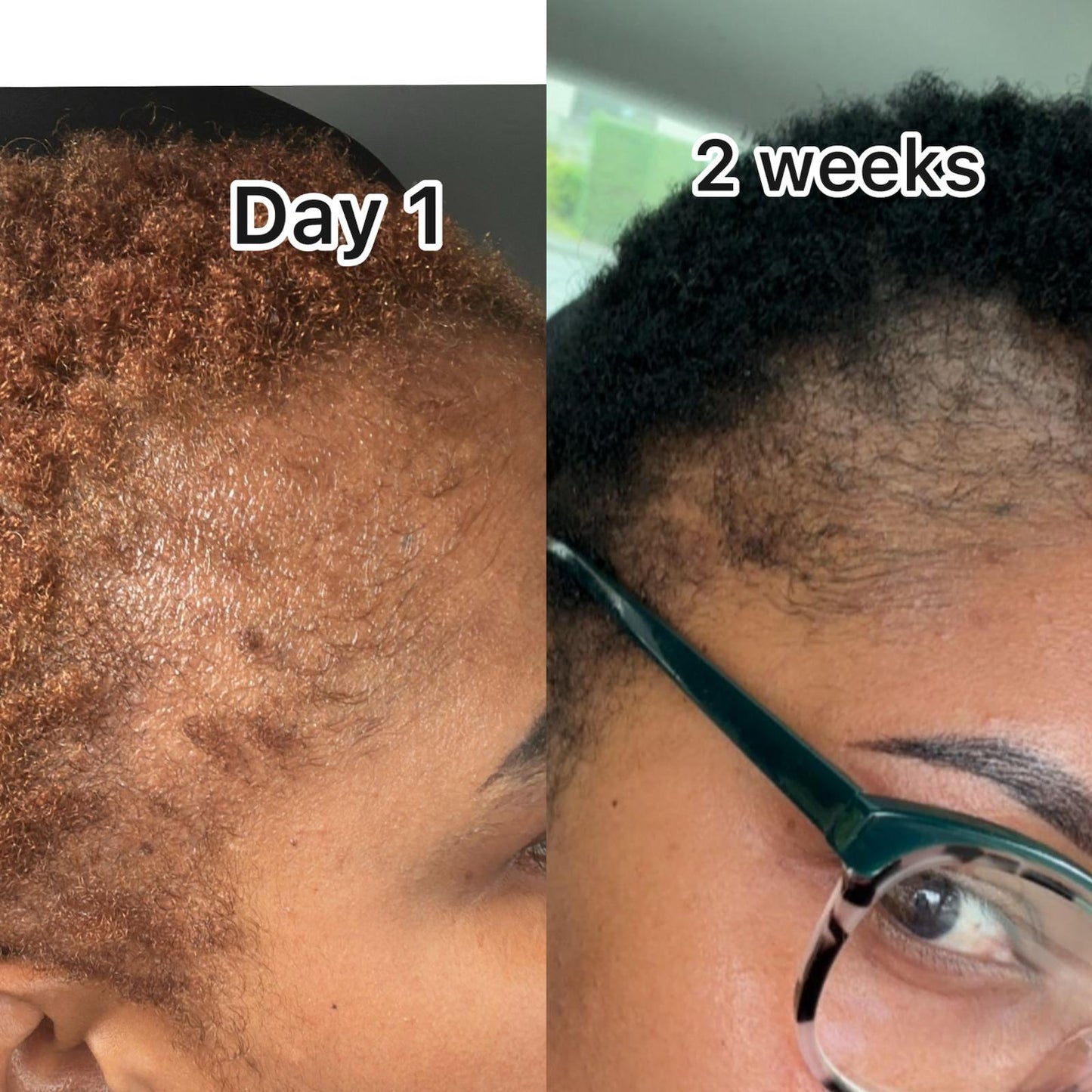 VIVA'S CROWN - 7 DAYS HAIR GROWTH ELIXIR