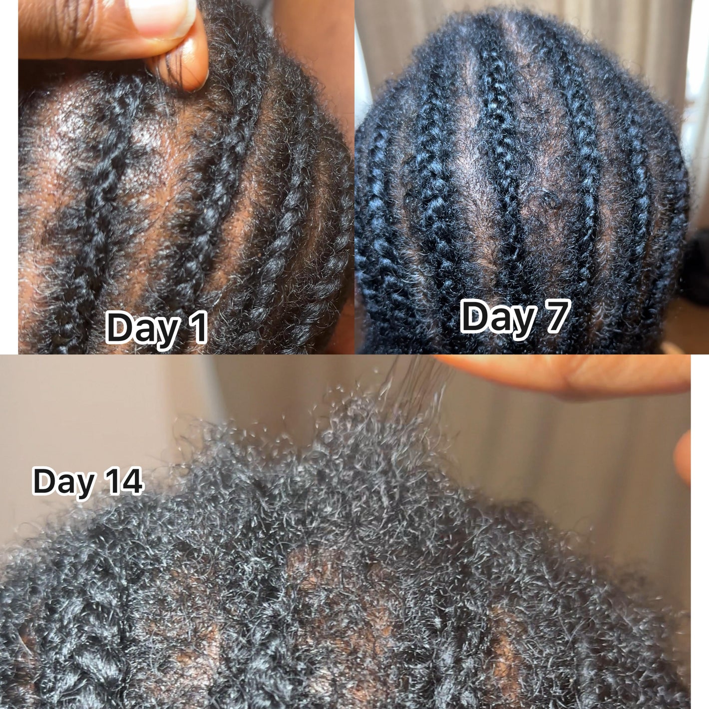 Before and after hair growth comparison over 14 days.